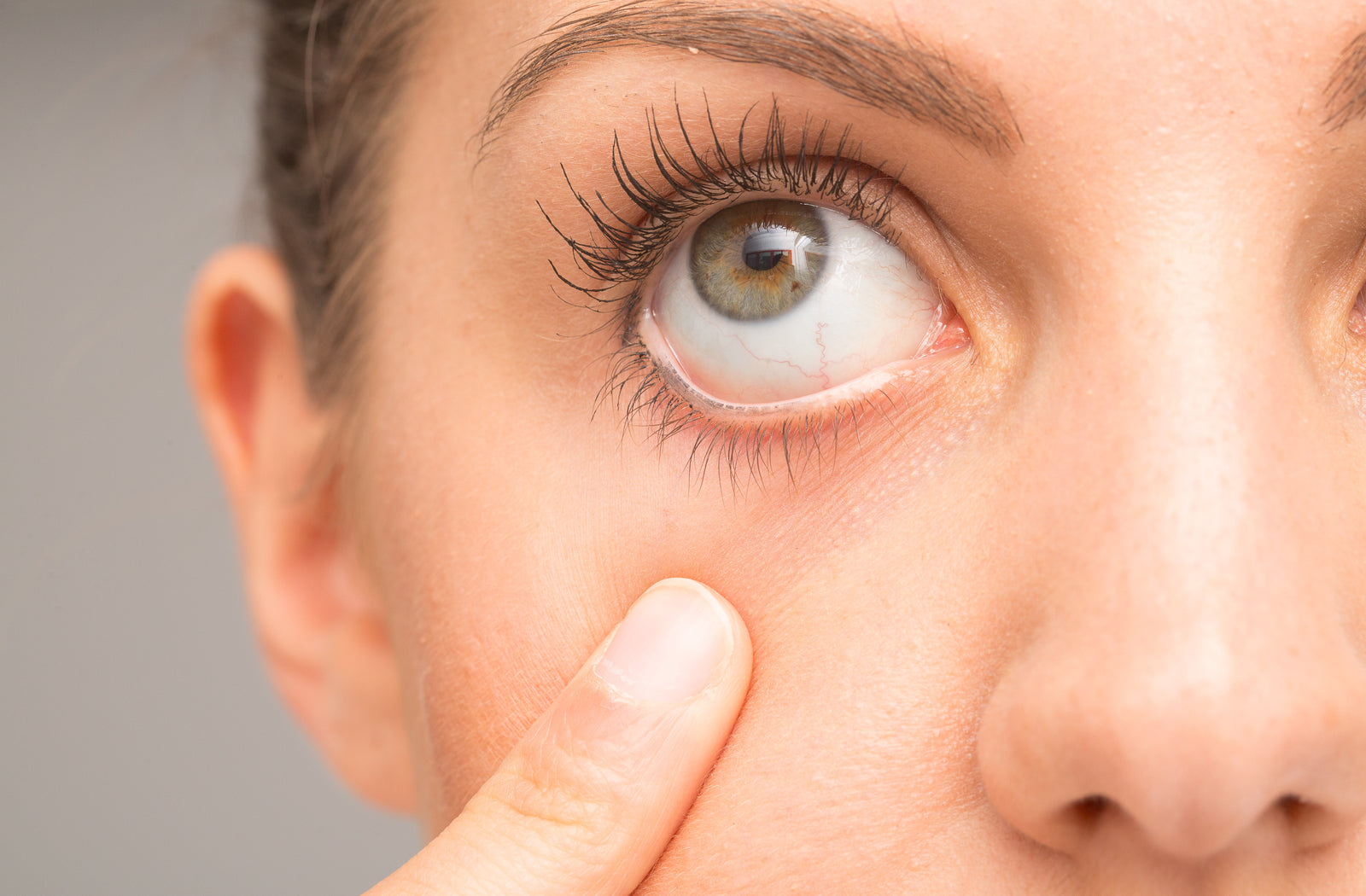 Omega-3: A Natural Remedy for Dry Eye Syndrome